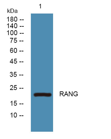 Western blot analysis of lysates from SW480 cells, primary antibody was diluted at 1:1000, 4°over night