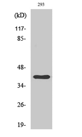 Cathepsin H rabbit pAb – Figure 1 of 1
