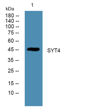Western blot analysis of lysates from DU145 cells, primary antibody was diluted at 1:1000, 4°over night