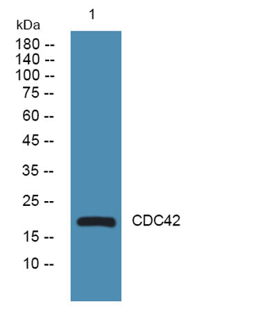 Western blot analysis of lysates from U2OS cells, primary antibody was diluted at 1:1000, 4°over night