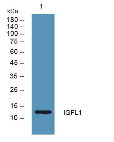 Western blot analysis of lysates from KB cells, primary antibody was diluted at 1:1000, 4°over night