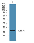 Western blot analysis of lysates from KB cells, primary antibody was diluted at 1:1000, 4°over night