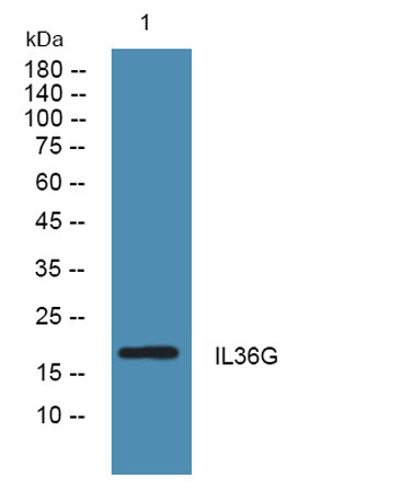 Western blot analysis of lysates from KB cells, primary antibody was diluted at 1:1000, 4°over night