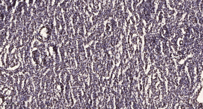 HUWE1 rabbit pAb – Figure 1 of 1