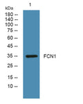 Western blot analysis of lysates from A431 cells, primary antibody was diluted at 1:1000, 4°over night