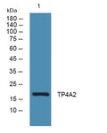TP4A2 rabbit pAb – Figure 1 of 1