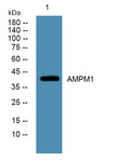Western blot analysis of lysates from K562 cells, primary antibody was diluted at 1:1000, 4°over night
