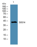 Western blot analysis of lysates from U2OS cells, primary antibody was diluted at 1:1000, 4°over night