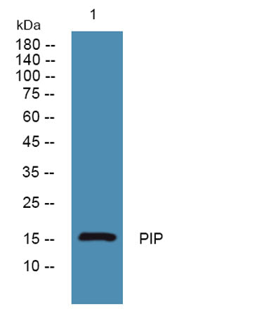 Western blot analysis of lysates from K562 cells, primary antibody was diluted at 1:1000, 4°over night