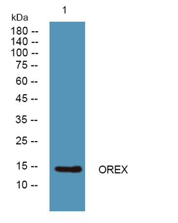 Western blot analysis of lysates from PC12 cells, primary antibody was diluted at 1:1000, 4°over night