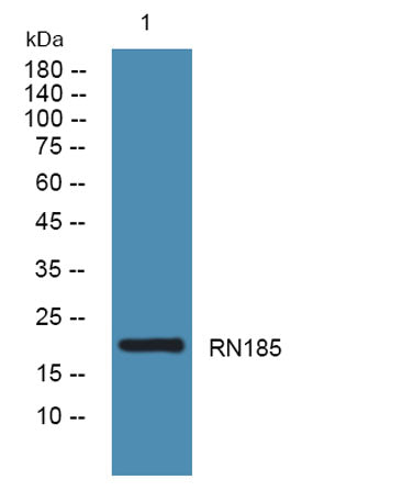 Western blot analysis of lysates from K562 cells, primary antibody was diluted at 1:1000, 4°over night