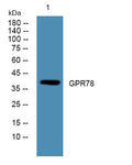 Western blot analysis of lysates from A431 cells, primary antibody was diluted at 1:1000, 4°over night