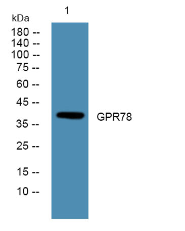 Western blot analysis of lysates from A431 cells, primary antibody was diluted at 1:1000, 4°over night