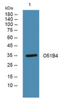 Western blot analysis of lysates from Jarkat cells, primary antibody was diluted at 1:1000, 4°over night