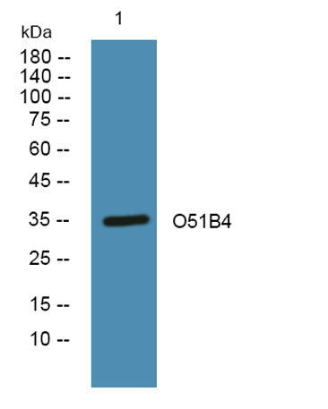 Western blot analysis of lysates from Jarkat cells, primary antibody was diluted at 1:1000, 4°over night