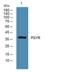 PSYR rabbit pAb – Figure 1 of 1