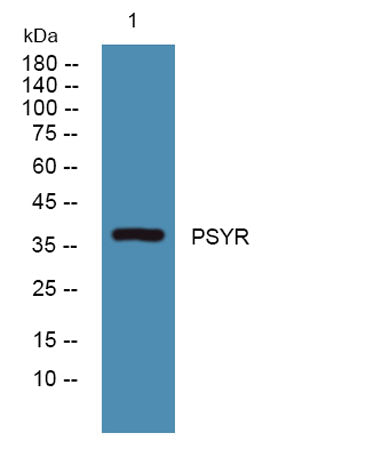 PSYR rabbit pAb – Figure 1 of 1