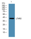 Western blot analysis of lysates from K562 cells, primary antibody was diluted at 1:1000, 4°over night