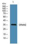 Western blot analysis of lysates from KB cells, primary antibody was diluted at 1:1000, 4°over night