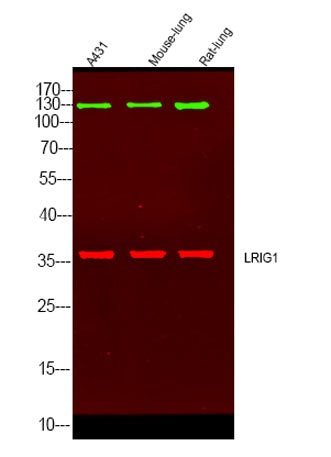 Western Blot analysis of varius cell lysis. Primary Antibody was diluted at 1:1000. Secondary antibody(catalog#:RS23920 was diluted at 1:10000