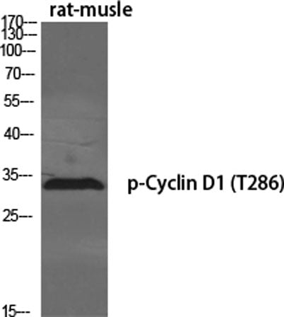 Cyclin D1 (phospho Thr286) rabbit pAb – Figure 1 of 4