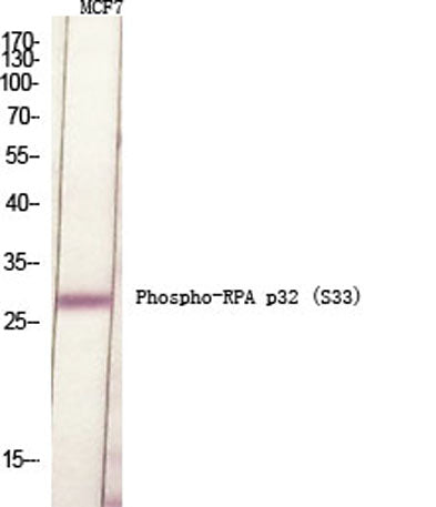 Western Blot analysis of various cells using Phospho-RPA p32 (S33) Polyclonal Antibody diluted at 1:500 cells nucleus extracted by Minute TM Cytoplasmic and Nuclear Fractionation kit