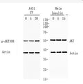 Western blot analysis of lysates from A431 and Hela cells treated with UV or insulin 0.01U/ml, using AKT p-308 Antibody.