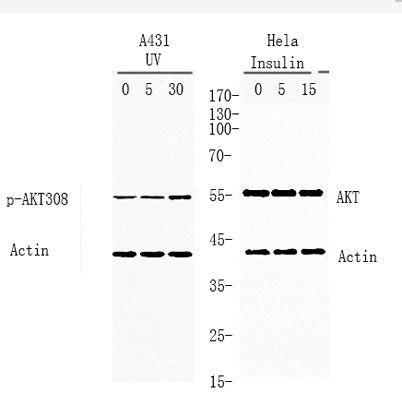 Western blot analysis of lysates from A431 and Hela cells treated with UV or insulin 0.01U/ml, using AKT p-308 Antibody.