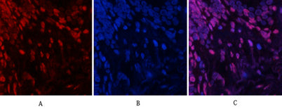 Immunofluorescence analysis of human-lung tissue.