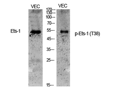 Western Blot analysis of various cells using Phospho-Ets-1 (T38) Polyclonal Antibody cells nucleus extracted by Minute TM Cytoplasmic and Nuclear Fractionation kit (SC-003,Inventbiotech,MN,USA).