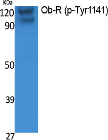 Western Blot analysis of extracts from K562 cells, using Phospho-Ob-R (Y1141) Polyclonal Antibody.