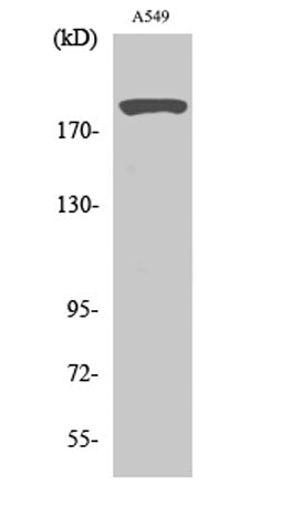Western Blot analysis of various cells using 53BP1 Polyclonal Antibody diluted at 1:2000