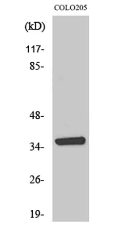 AASD-PPT rabbit pAb – Figure 1 of 3