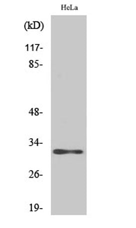 Western Blot analysis of various cells using AIG-1 Polyclonal Antibody
