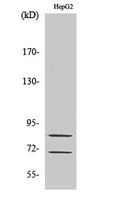 Western Blot analysis of various cells using Choactase Polyclonal Antibody diluted at 1:1000
