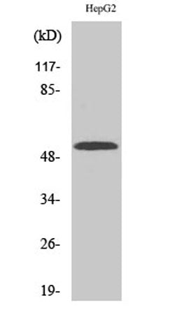 Western Blot analysis of various cells using CYP2W1 Polyclonal Antibody