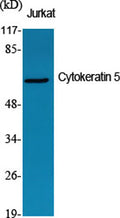 Cytokeratin 5 rabbit pAb – Figure 1 of 4