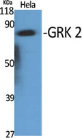 GRK 2 rabbit pAb – Figure 1 of 4