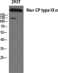 Na+ CP type IXα rabbit pAb – Figure 1 of 2