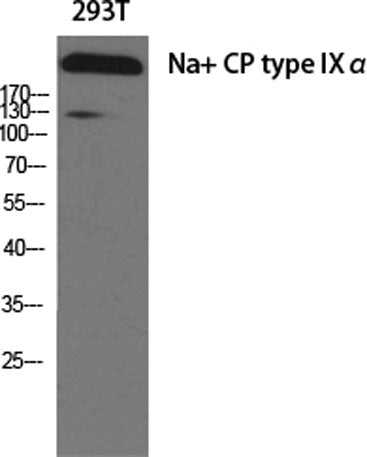 Na+ CP type IXα rabbit pAb – Figure 1 of 2