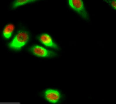 NFκB-p65 rabbit pAb – Figure 1 of 4