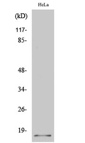 Western Blot analysis of various cells using p14 Polyclonal Antibody diluted at 1:500
