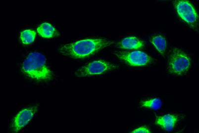 p21 rabbit pAb – Figure 1 of 4