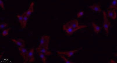 PDGFR-β rabbit pAb – Figure 1 of 1