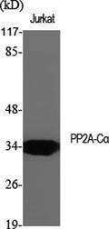 Western Blot analysis of various cells using PP2A-Cα Polyclonal Antibody diluted at 1:2000