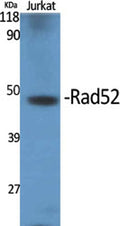 Western Blot analysis of various cells using Rad52 Polyclonal Antibody cells nucleus extracted by Minute TM Cytoplasmic and Nuclear Fractionation kit (SC-003,Inventbiotech,MN,USA).