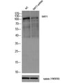 Western blot analysis of lysates from 1)Mouse Ovarian granulosa cell , 2)Mouse Ovarian granulosa cell knockdown by SIRT1-siRNA, primary antibody was diluted at 1:1000, 4°over night, secondary antibody(Immunoway:RS0002)was diluted at 1:10000, 37° 1hour. β-Tubulin Monoclonal Antibody(5G3) (Immunoway:YM3030) antibody was diluted at 1:5000 as loading control, 4° over night, secondary antibody(Immunoway:RS0001)was diluted at 1:10000, 37° 1hour.