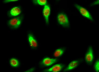 Skp2 p45 rabbit pAb – Figure 1 of 4