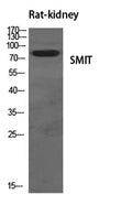 Western Blot analysis of various cells using SMIT Polyclonal Antibody diluted at 1:500