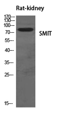 Western Blot analysis of various cells using SMIT Polyclonal Antibody diluted at 1:500
